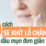 10 cách se khít lỗ chân lông cho da dầu mụn đơn giản tại nhà