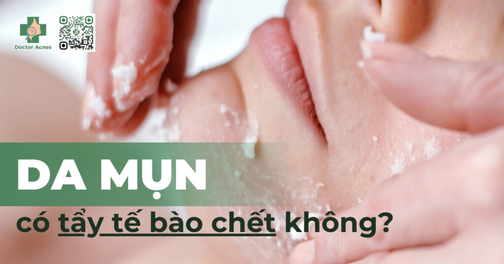 Da mụn có nên tẩy tế bào chết không?