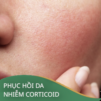 dịch vụ phục hồi da nhiễm corticoid