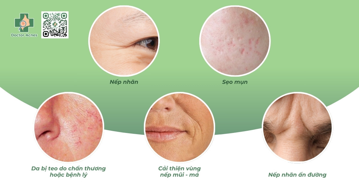 khi nào cần tiêm collagen