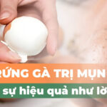 Lăn trứng gà trị mụn có thật sự hiệu quả như lời đồn?