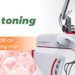 Laser toning là gì? Bí quyết để có làn da sáng mịn