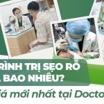 Liệu trình trị sẹo rỗ giá bao nhiêu? Bảng giá mới nhất tại Doctor Acnes