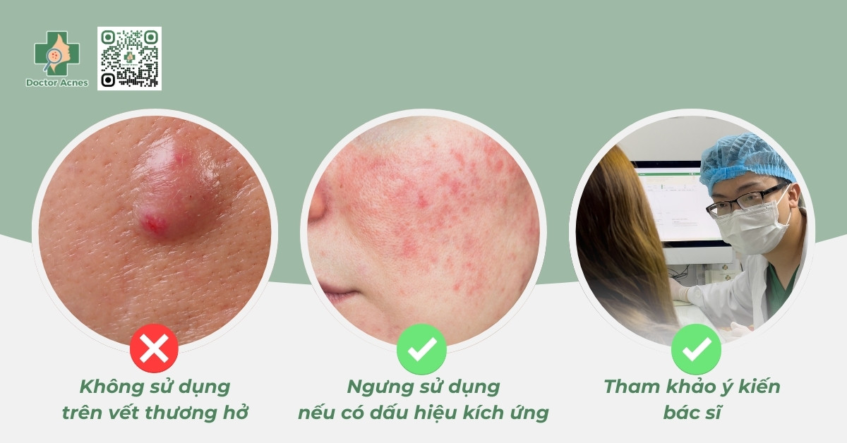 những lưu ý khi sử dụng miếng dán mụn