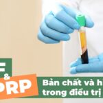 PRF và PRP: bản chất, hiệu quả trong điều trị sẹo