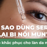 Tại sao dùng serum lại bị nổi mụn? Giải pháp khắc phục lấy lại làn da mịn màng