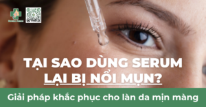 tại sao dùng serum bị nổi mụn