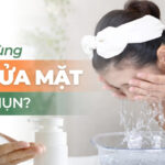 Tại sao dùng sữa rửa mặt lại nổi mụn?