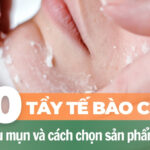 Top 10 tẩy tế bào chết cho da dầu mụn và cách chọn sản phẩm phù hợp
