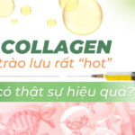 Tiêm collagen là gì? Hiện có còn phổ biến?
