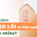 Thuốc tiêm trị sẹo lồi có hiệu quả không? Giá bao nhiêu?