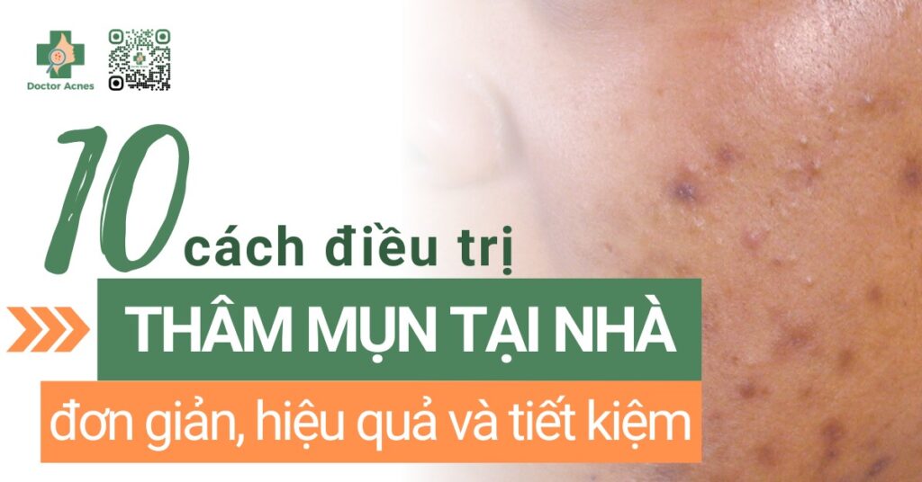trị thâm mụn tại nhà
