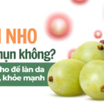 Ăn nho có nổi mụn không? Cách ăn nho để làn da sạch mụn, khỏe mạnh
