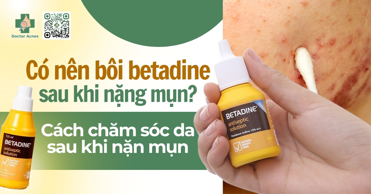 bôi betadine sau khi nặn mụn