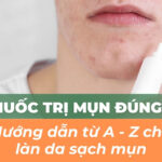 Bôi thuốc trị mụn đúng cách: hướng dẫn từ A – Z cho làn da sạch mụn