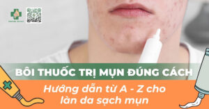 bôi thuốc trị mụn đúng cách