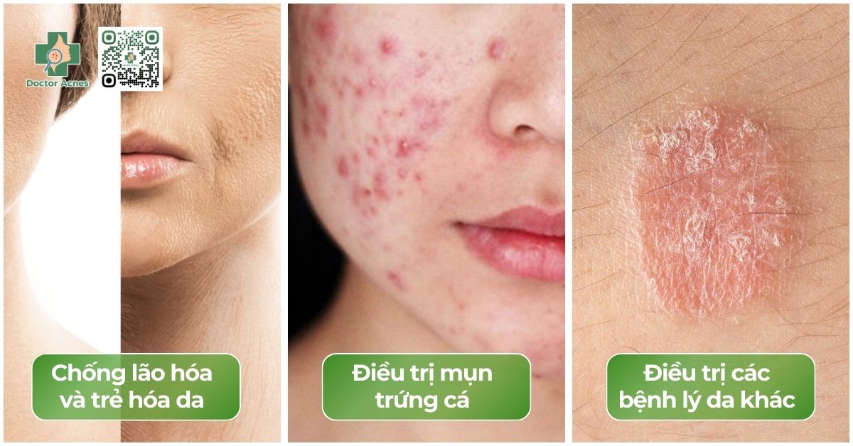 công dụng của retinoid