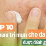 Top 10 loại kem trị mụn cho da dầu được đánh giá cao