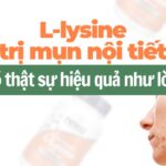 L-lysine trị mụn nội tiết có thật sự hiệu quả như lời đồn?