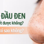Mụn đầu đen có tự hết được không? Để lâu có sao không?