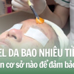 Peel da bao nhiêu tiền và nên chọn cơ sở nào để đảm bảo uy tín?