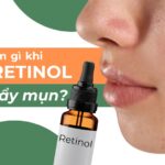 Cần làm gì khi dùng retinol bị đẩy mụn?