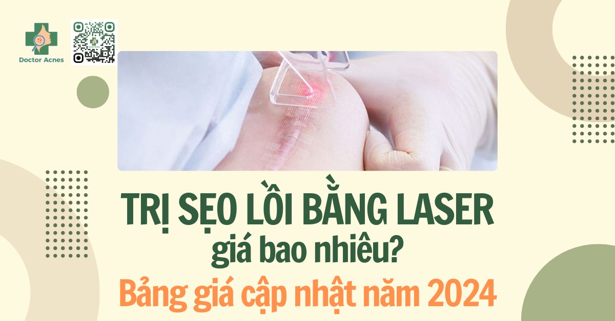 trị sẹo lồi bằng laser giá bao nhiêu