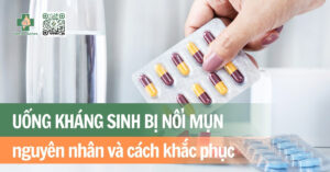 uống kháng sinh bị nổi mụn