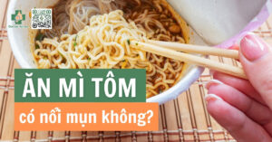 ăn mì tôm có nổi mụn không