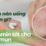 Bị mụn nên uống vitamin gì? Top 6 vitamin tốt cho da mụn