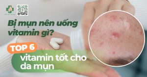 bị mụn nên uống vitamin gì