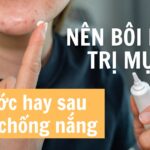Nên bôi kem trị mụn trước hay sau kem chống nắng?