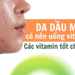 Da dầu mụn có nên uống vitamin E? Các vitamin tốt cho da mụn