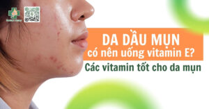 da dầu mụn có nên uống vitamin e