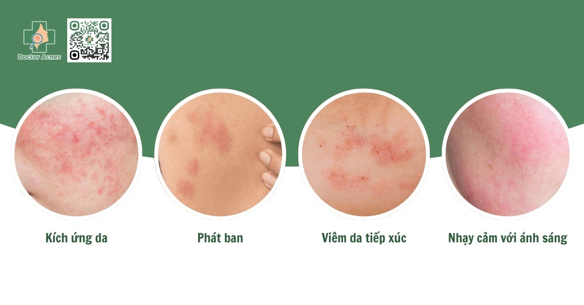 tác dụng phụ clindamycin