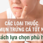 Các loại thuốc trị mụn trứng cá tốt nhất và cách lựa chọn phù hợp