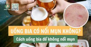 uống bia có nổi mụn không