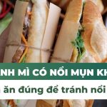 Ăn bánh mì có nổi mụn không? Cách ăn đúng để tránh nổi mụn