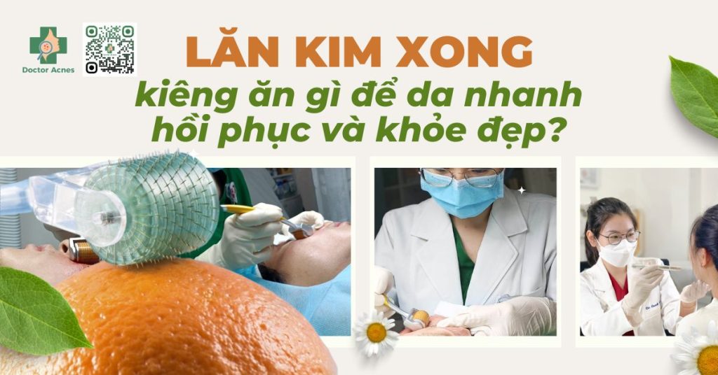 lăn kim xong kiêng ăn gì