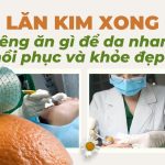 Lăn kim xong kiêng ăn gì để da nhanh hồi phục và khỏe đẹp?
