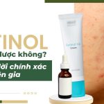 Retinol trị mụn được không? Câu trả lời chính xác từ chuyên gia