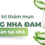 4 cách trị thâm mụn bằng nha đam đơn giản tại nhà