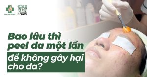 bao lâu peel da một lần