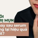 Nên bôi kem trị mụn trước hay sau serum để mang lại hiệu quả tốt nhất?