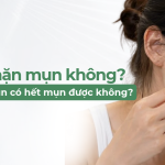 Có nên nặn mụn không? Lấy nhân mụn có hết mụn được không?