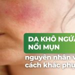 Da khô, ngứa và nổi mụn: nguyên nhân và cách khắc phục