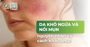 Da khô, ngứa và nổi mụn: nguyên nhân và cách khắc phục