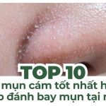 Top 10 kem trị mụn cám tốt nhất hiện nay giúp đánh bay mụn tại nhà