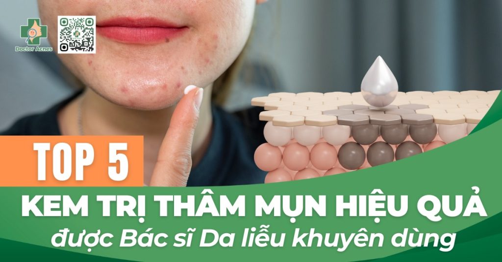 Top 5 kem trị thâm mụn hiệu quả nhất