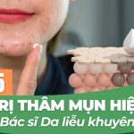 Top 5 kem trị thâm mụn hiệu quả được Bác sĩ Da liễu khuyên dùng